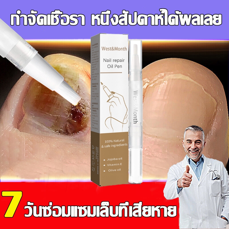 7วัน ซ่อมแซมเล็บเสียอย่างรวดเร็ว เล็บเชื้อรา บำรุงเล็บ กันเชื้อราเล็บ เซรั่มบำรุงเล็บ เชื้อราเล็บมือ แก้เชื้อราที่เล็บ
