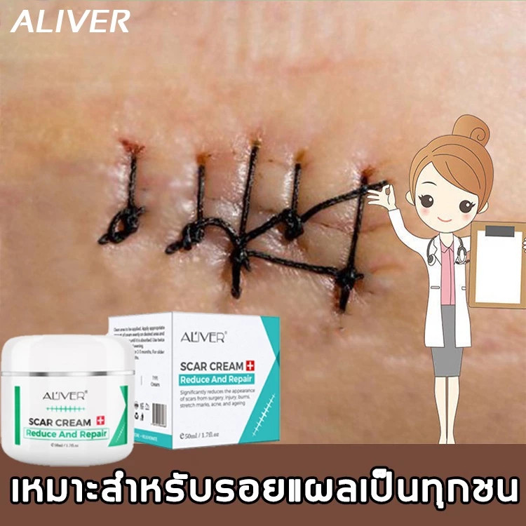 ALIVER Repair Scar Scar Cream Remove Stretch Mark Scald Caesarean Bump Surgery Scar ครีมลดรอยแผลเป็น สูตรสมุนไพร 50ml